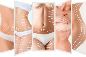 SLIMASPIRATION ANTI-CELLULITE Behandlung Berlin